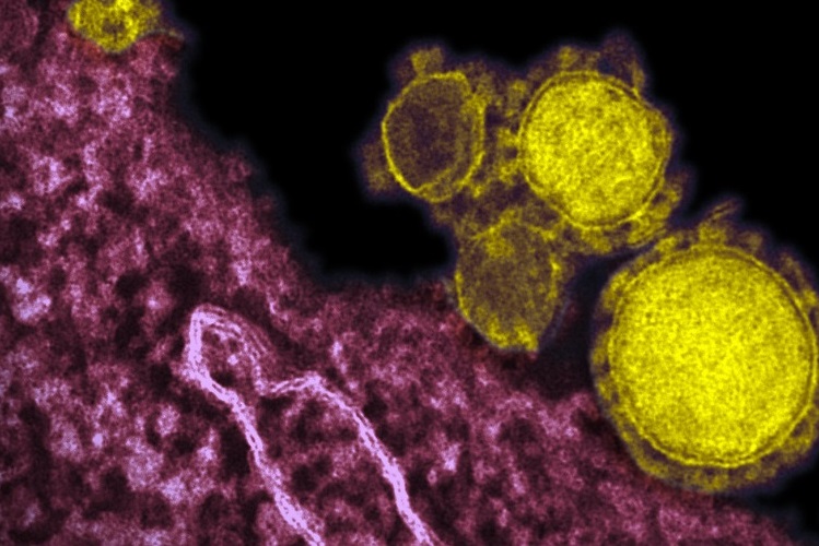 Person connected to Timmins school tested for coronavirus